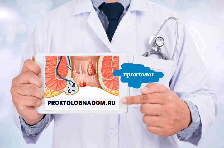 Проктолог - что это за врач и что он лечит? когда нужна его консультация? как подготовиться к посещению? что происходит у него на консультации?