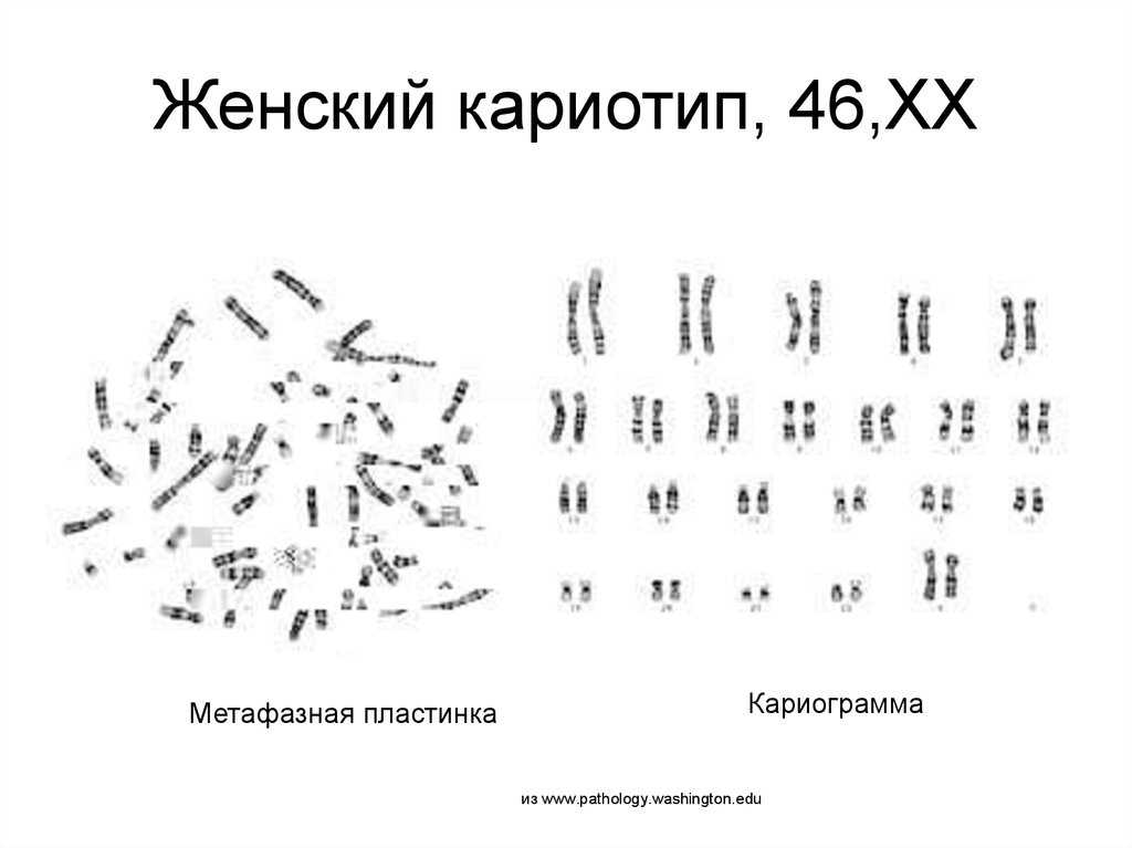 Правда о генетических анализах: биохимический скрининг, биопсия хориона, амниоцентез и прочие