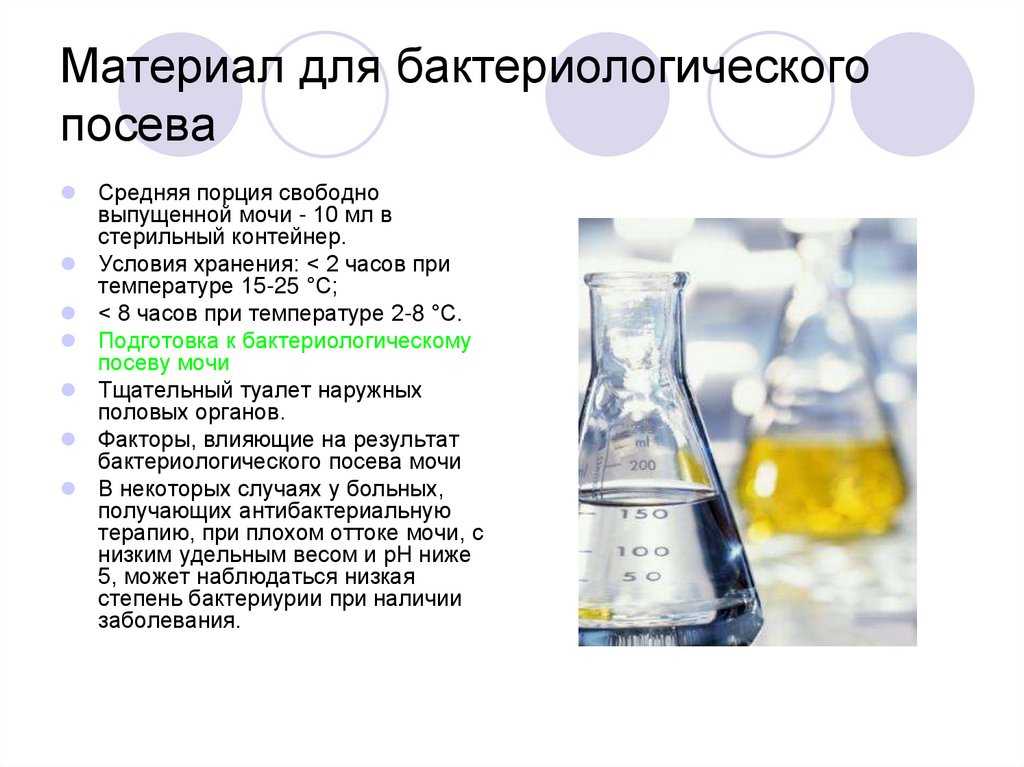 Бак посев мочи у ребенка - сдать анализ в спб