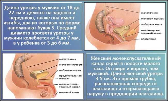 Эффективное лечение цистита у женщин