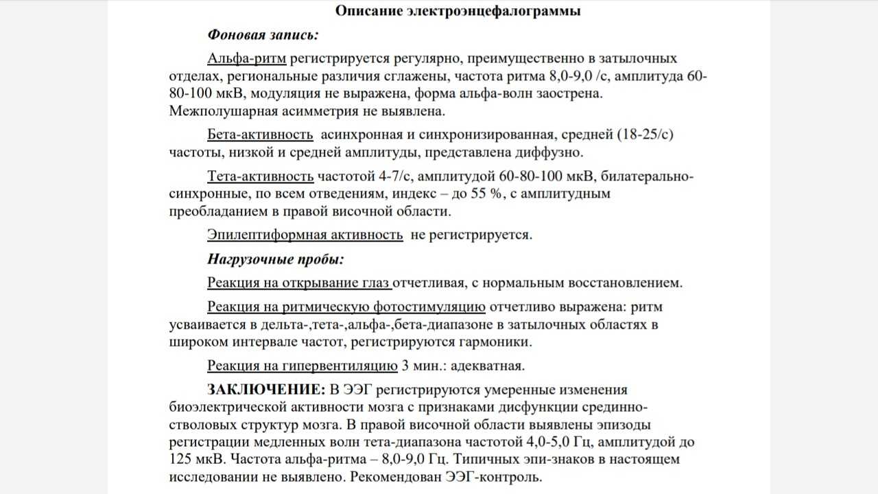 Электроэнцефалография (ээг)