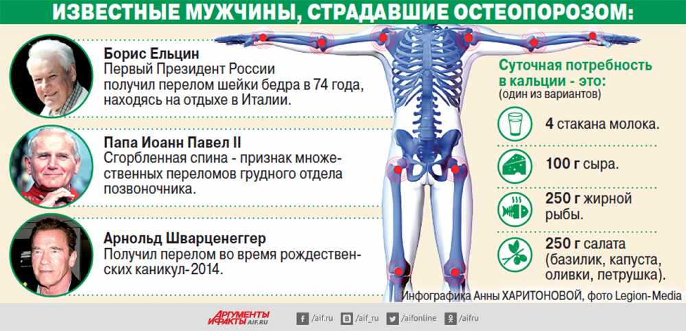Остеопороз: симптомы, факторы риска, диагностика и лечение заболевания скелета