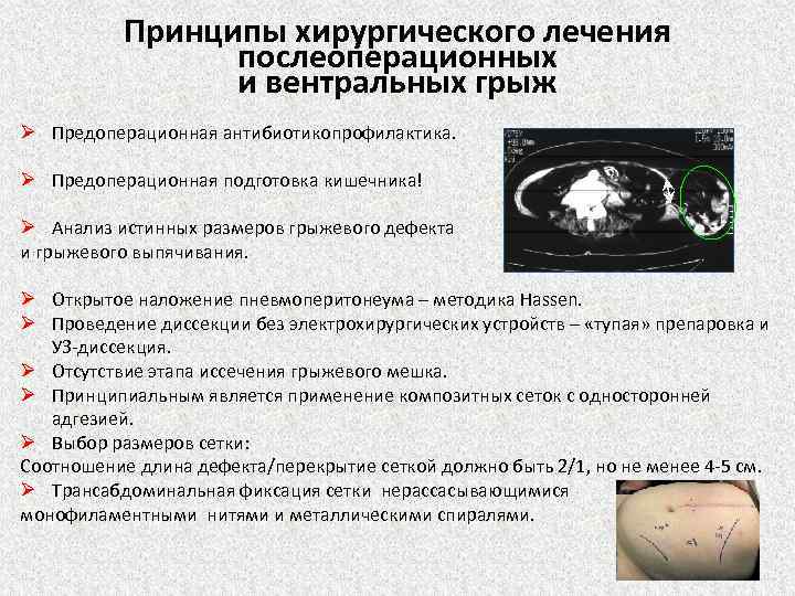 Премедикация перед операцией