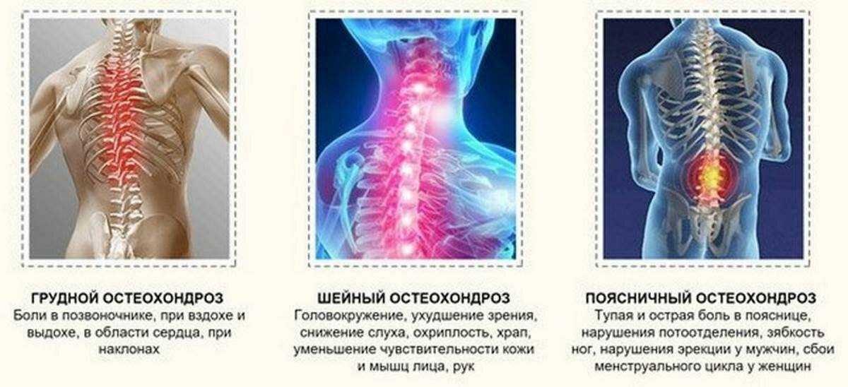 Стресс, как причина болей в спине | центр дикуля