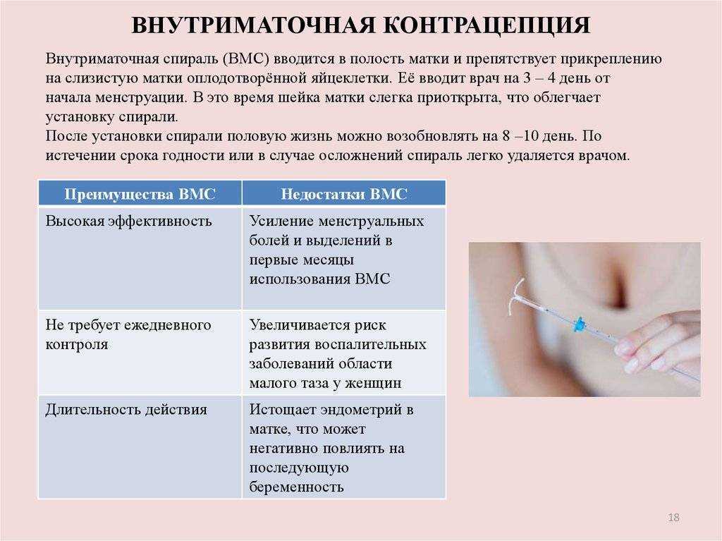 Введение внутриматочной спирали «мирена»