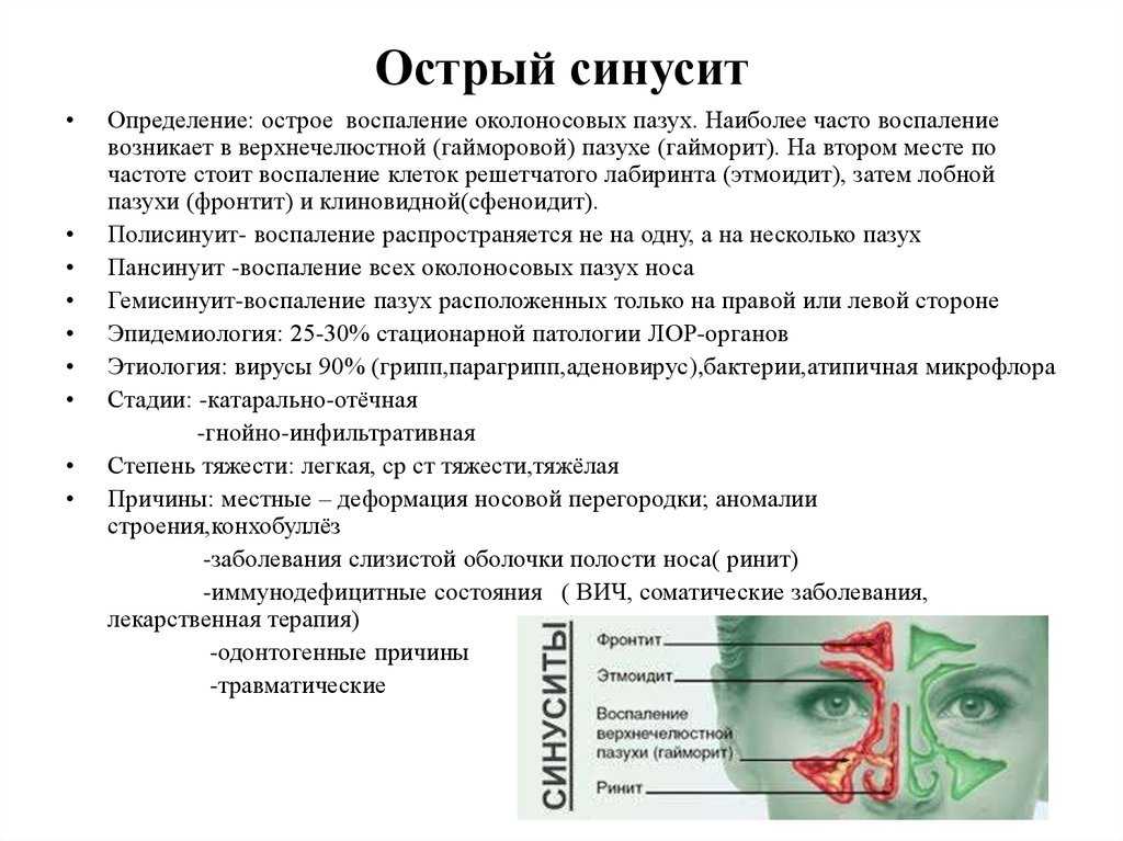 Синусит  | что такое, лечение, причины, осложнения, прогноз  | лор справочник