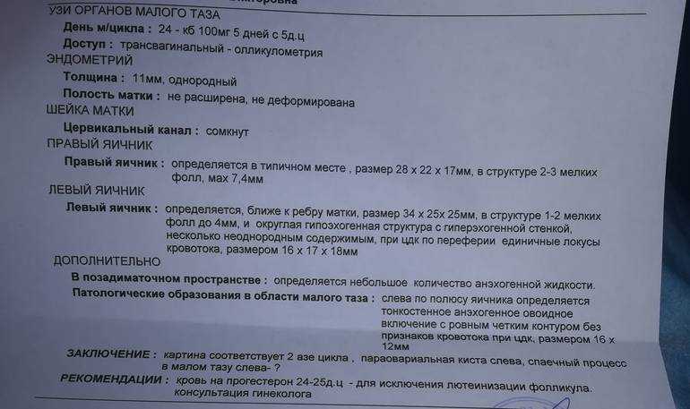 Что такое узи малого таза у женщин. Ультразвуковое исследование органов малого таза. Ультразвуковое исследование УЗИ органов малого таза. При УЗИ органов малого таза. Ультразвуковое УЗИ малого таза.