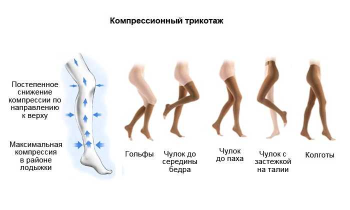 Компрессионный трикотаж 2-1 класса компрессии. советы флеболога