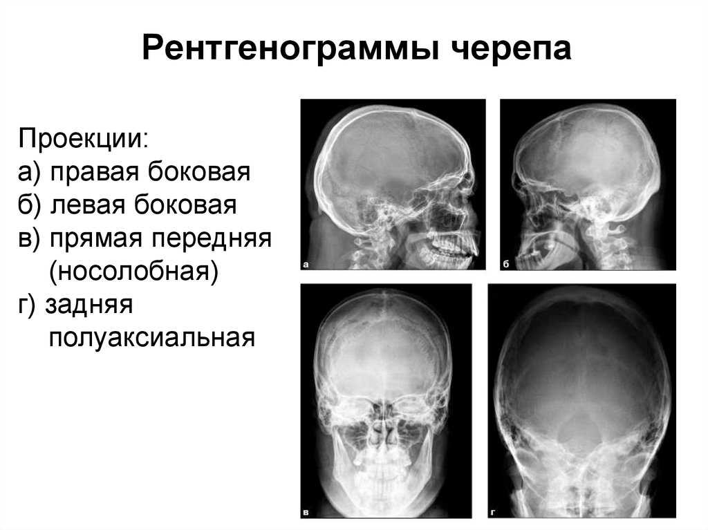 Кт основания черепа, что показывает исследование