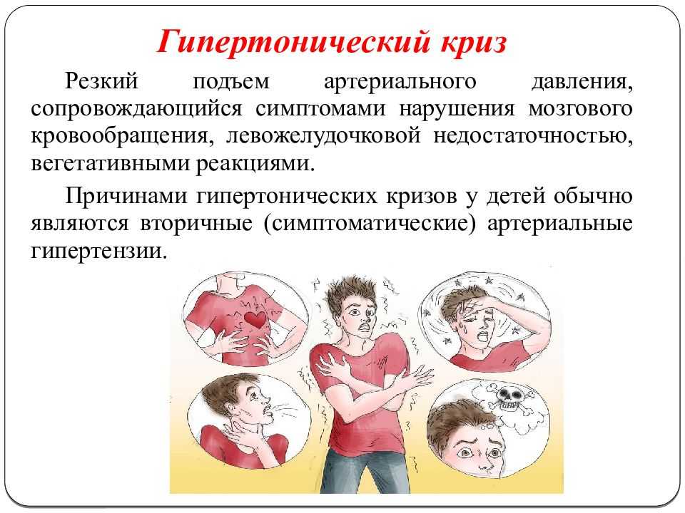 Гипертонический криз: симптомы, первая помощь и алгоритм действий