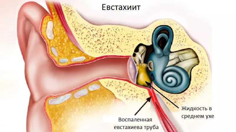 Заложенность уха – не безобидный симптом!