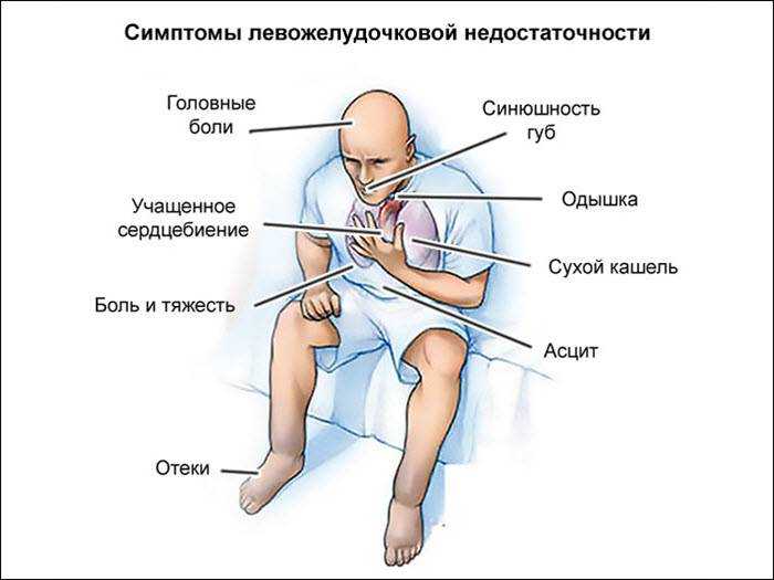Одышка – затруднение дыхания: диагностика причин и эффективное лечение