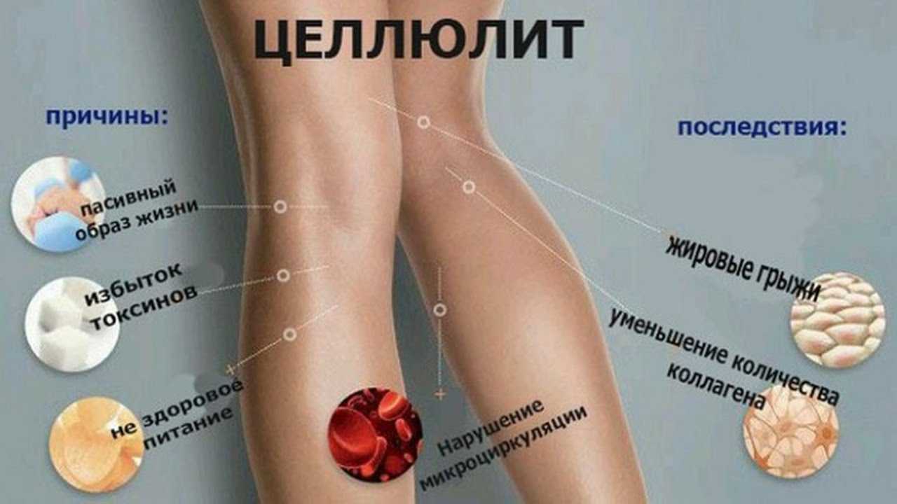 Самые эффективные салонные процедуры от целлюлита ✔️ блог клиники лица