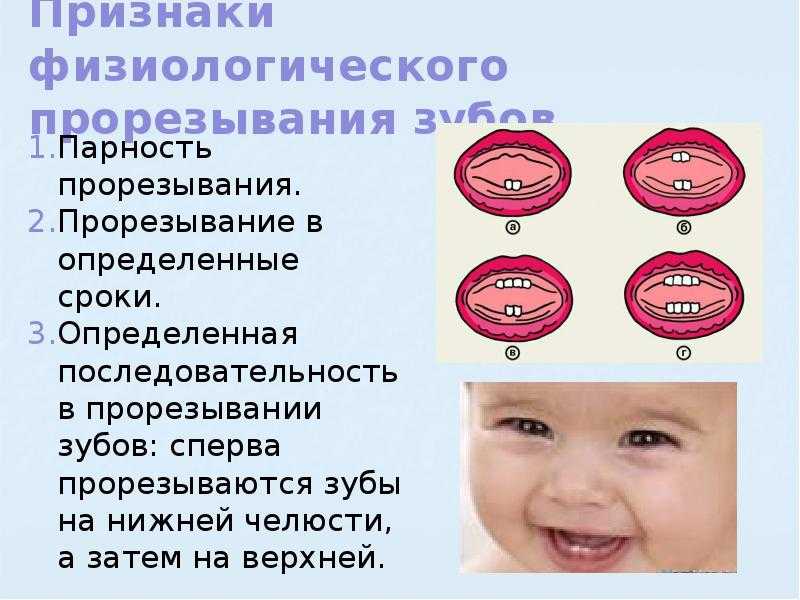 Коренные (постоянные) зубы у детей