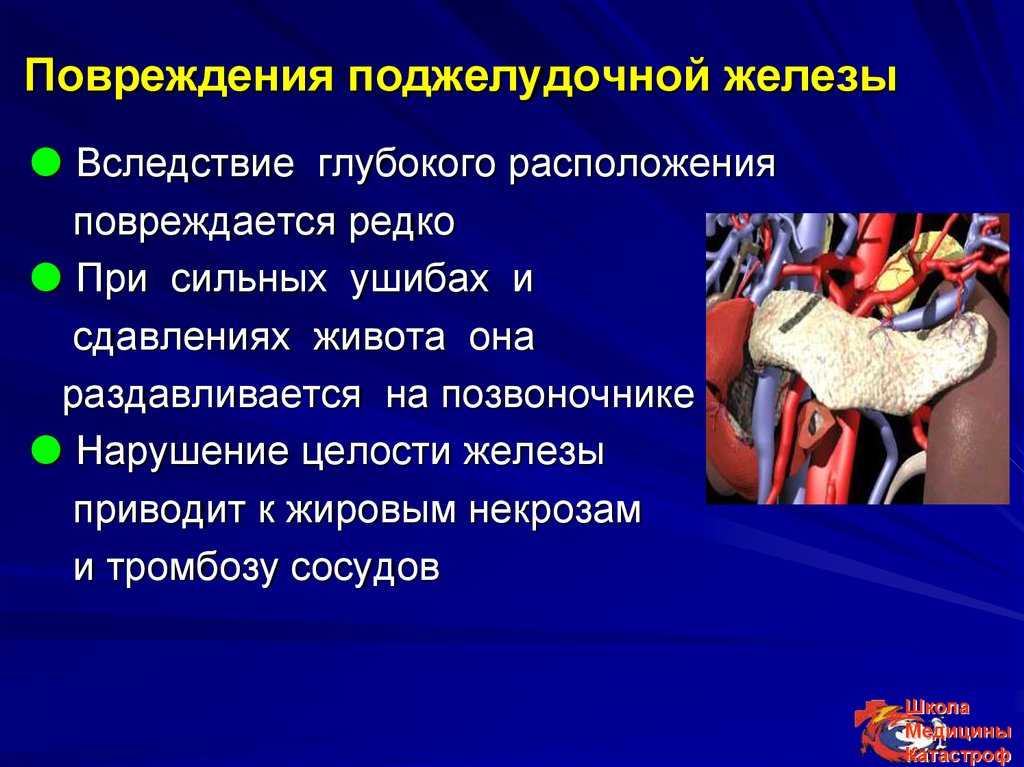 Что такое липоматоз поджелудочной железы. Повреждение поджелудочной железы. Повреждения поджелудочной железы травма. Ранение поджелудочной железы. Травматическое повреждение поджелудочной железы.