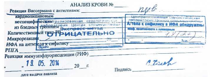 Сифилис rpr (антикардиолипиновый тест / микрореакция преципитации), титр: исследования в лаборатории kdlmed