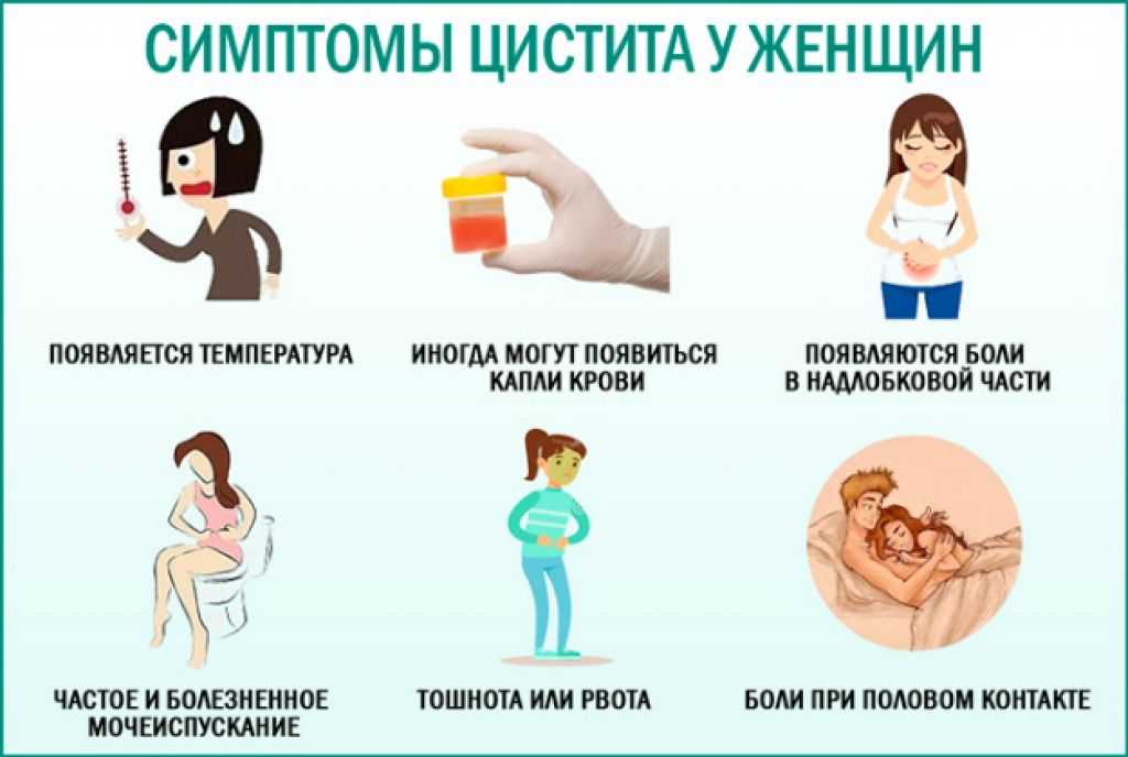 Цистит после секса у женщин симптомы и лечение. посткоитальный цистит.