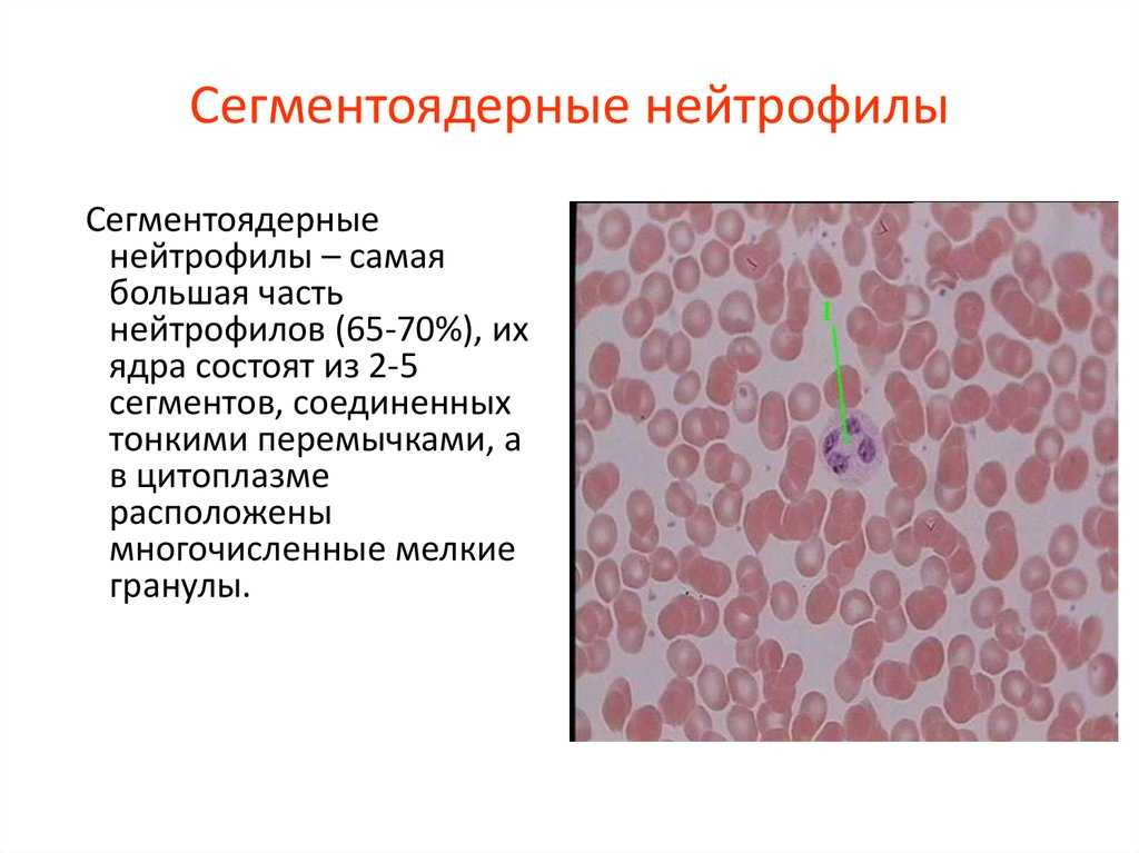 Нейтрофилы в крови: нормы по возрастам (таблица), причины повышения и снижения клеток