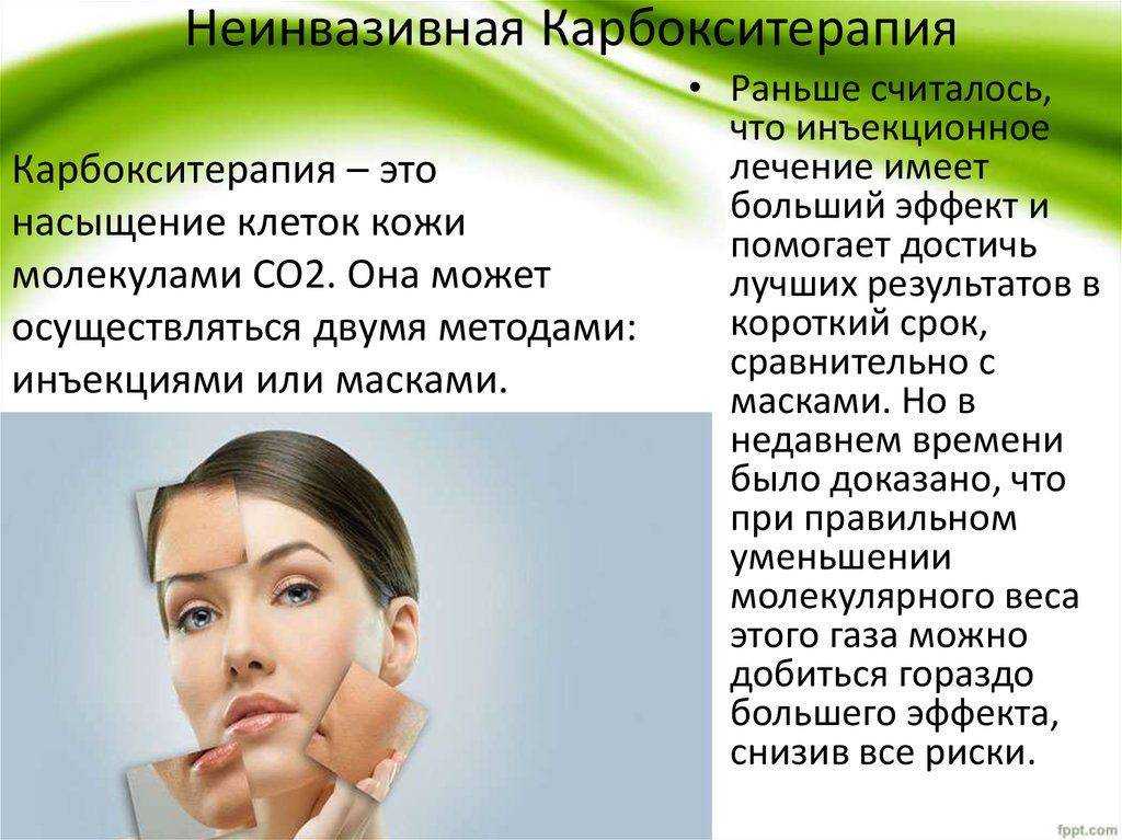 Карбокситерапия Для Лица Безинъекционная Отзывы Фото
