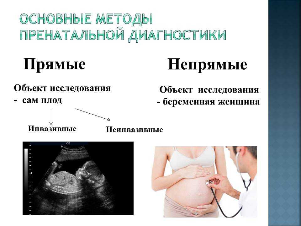 Пренатальная диагностика плода. Непрямой метод пренатальной диагностики. Методы дородовой диагностики. Неинвазивные методы дородовой диагностики. Инвазивные и неинвазивные методы пренатальной диагностики.