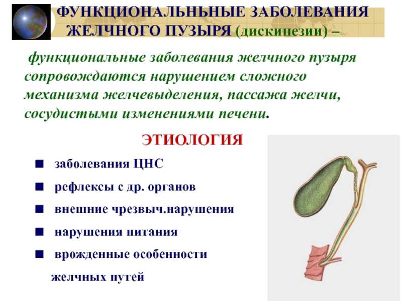 Как болит желчный пузырь: симптомы, чем лечить, причины боли желчного пузыря