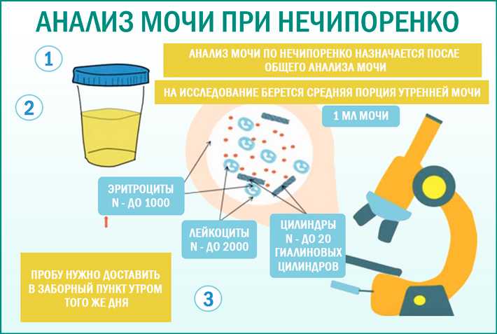 Общий анализ мочи