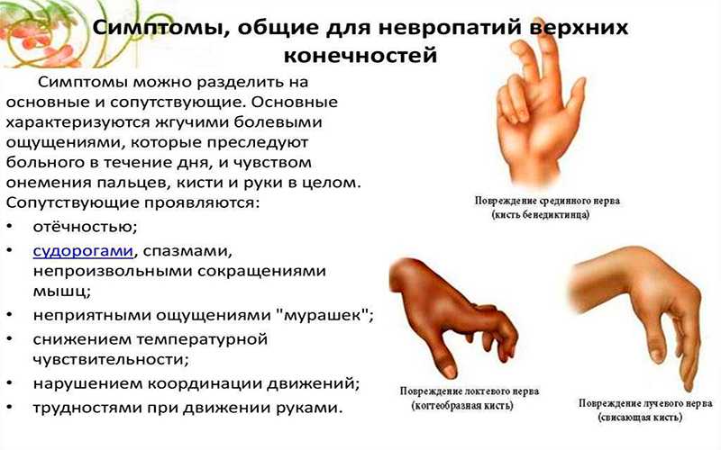 Почему происходит онемение. Немеет указательный палец левой руки причины. Немеет левая рука причины. Немеет рука от локтя до пальцев. Немеют пальцы на левой руке.