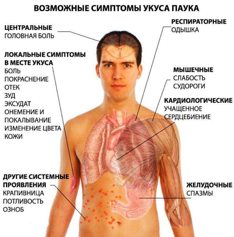 Укус паука: симптомы, последствия, что делать при укусе паука - medside.ru