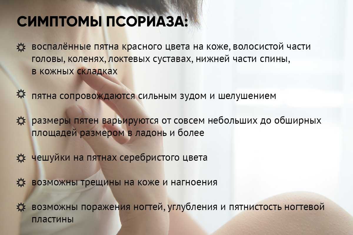 Псориаз - причины и лечение кожного заболевания