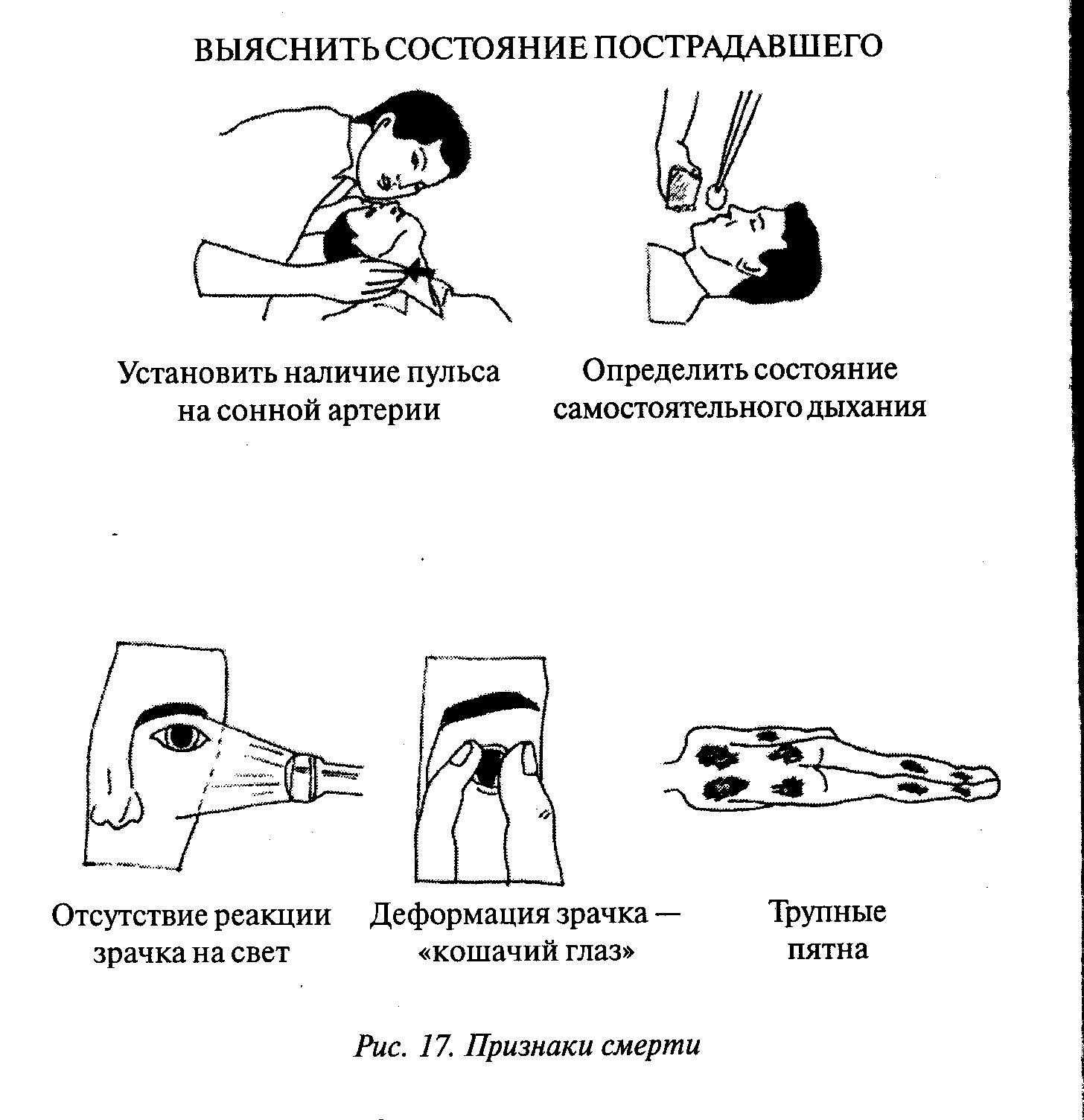 Первая помощь при обмороке: как оказать, последовательность | food and health