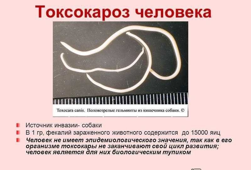 Токсокароз у детей - симптомы болезни, профилактика и лечение токсокароза у детей, причины заболевания и его диагностика на eurolab