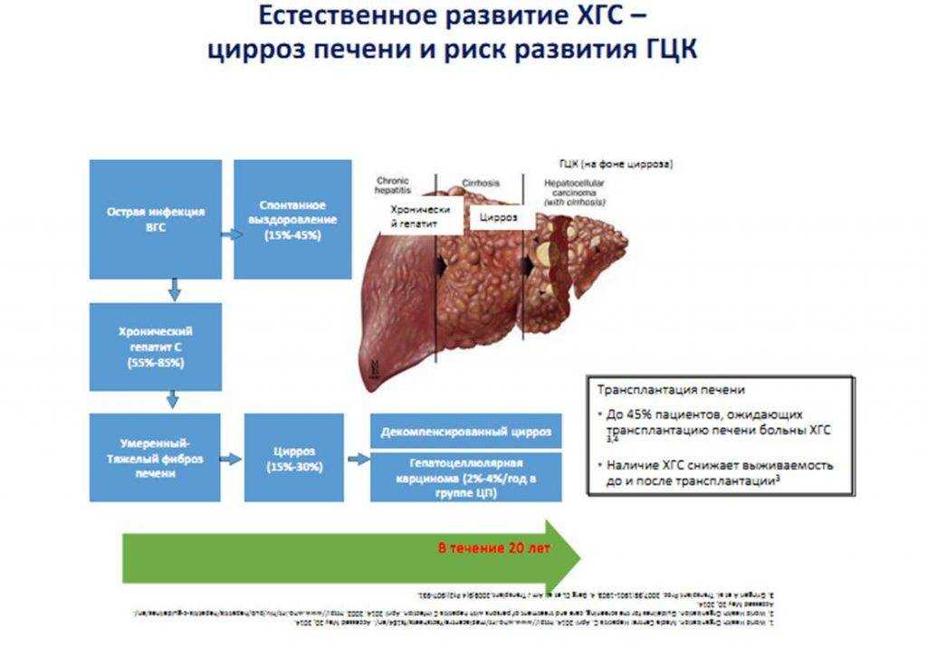 Гепатит б. симптомы, диагностика, последствия и лечение.!