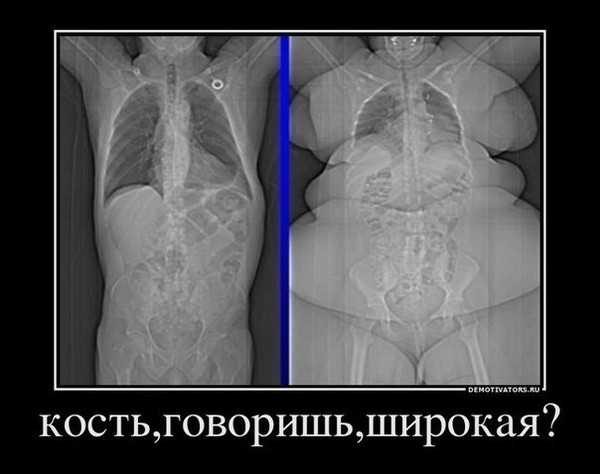 Тяжелые кости – тяжелые кости миф или реальность. стало интересно если такое тяжелые кости или нет или это просто выдумка полных людей ?
