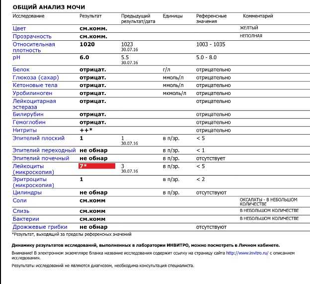 Общий анализ мочи (оам): норма и расшифровка результатов у взрослых в таблице