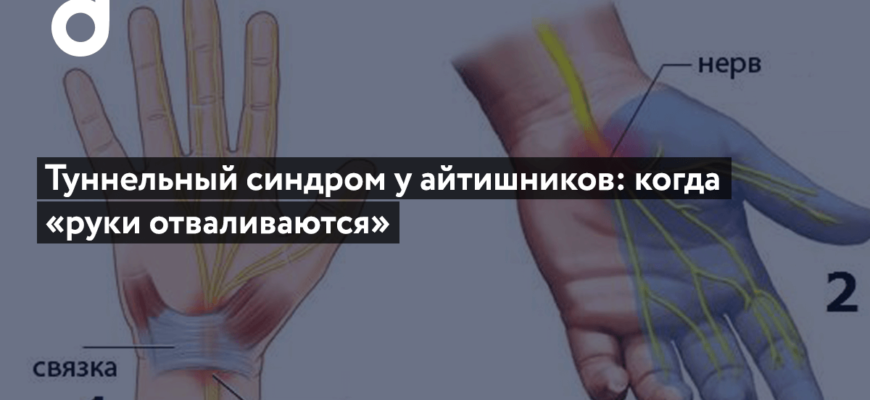 Туннельный синдром – причины, симптомы, диагностика и лечение
