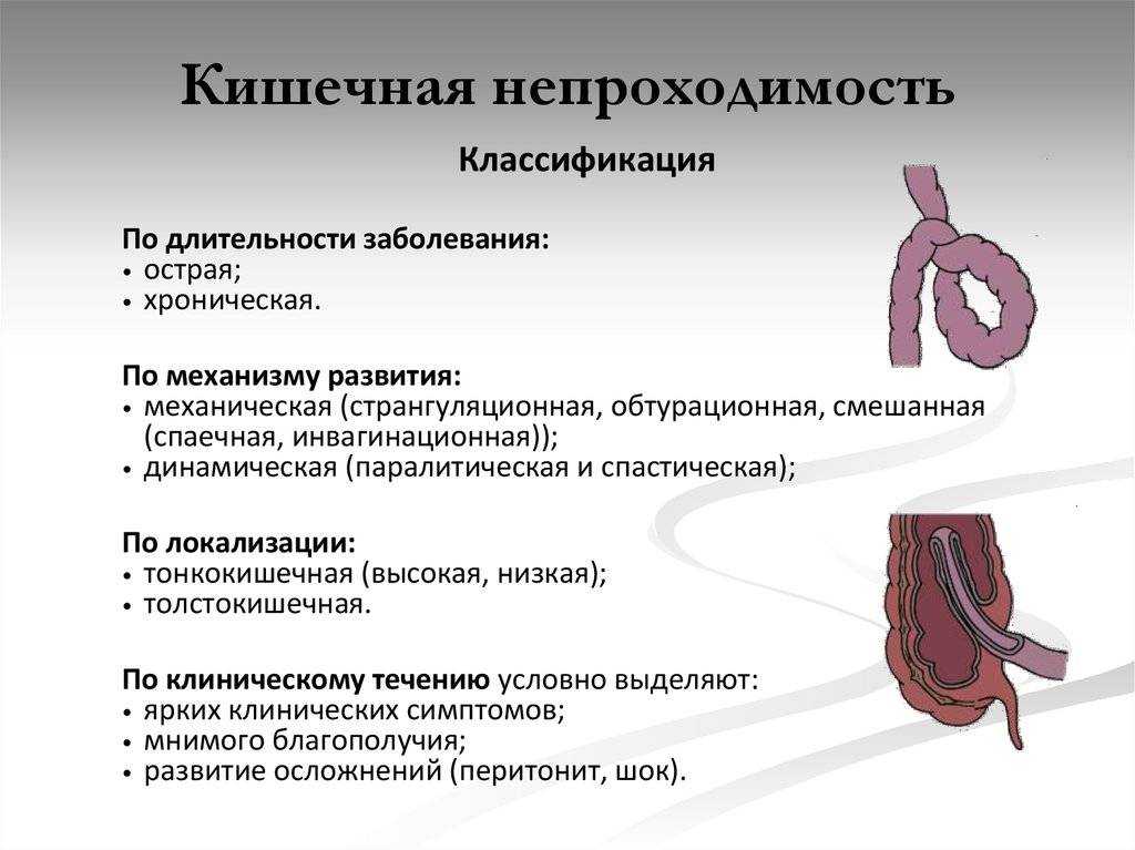 Заворот кишок - причины, симптомы, виды, диагностика и лечение у опытных врачей