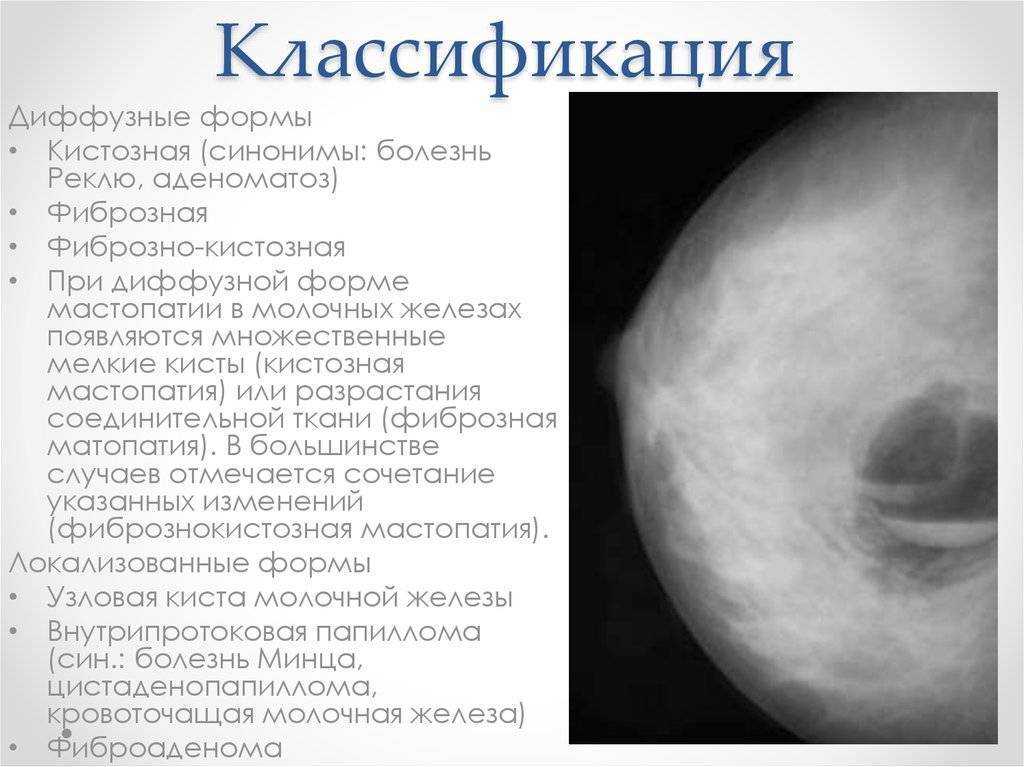 Волосы на сосках у женщин