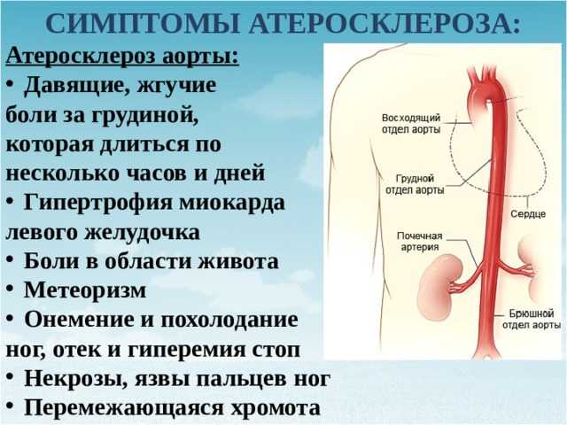 Покажет ли уздг исследование сосудов брюшной полости и дуплексное сканирование аорты и ее ветвей аневризму на узи?