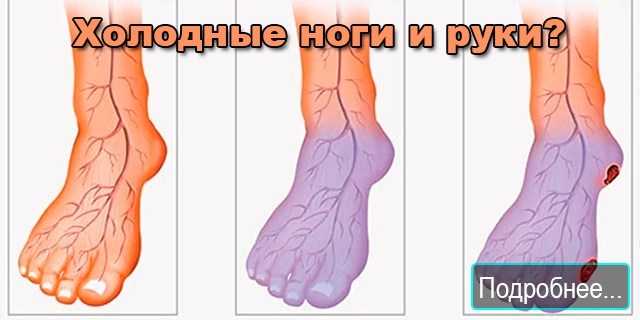 Почему мне всегда холодно?