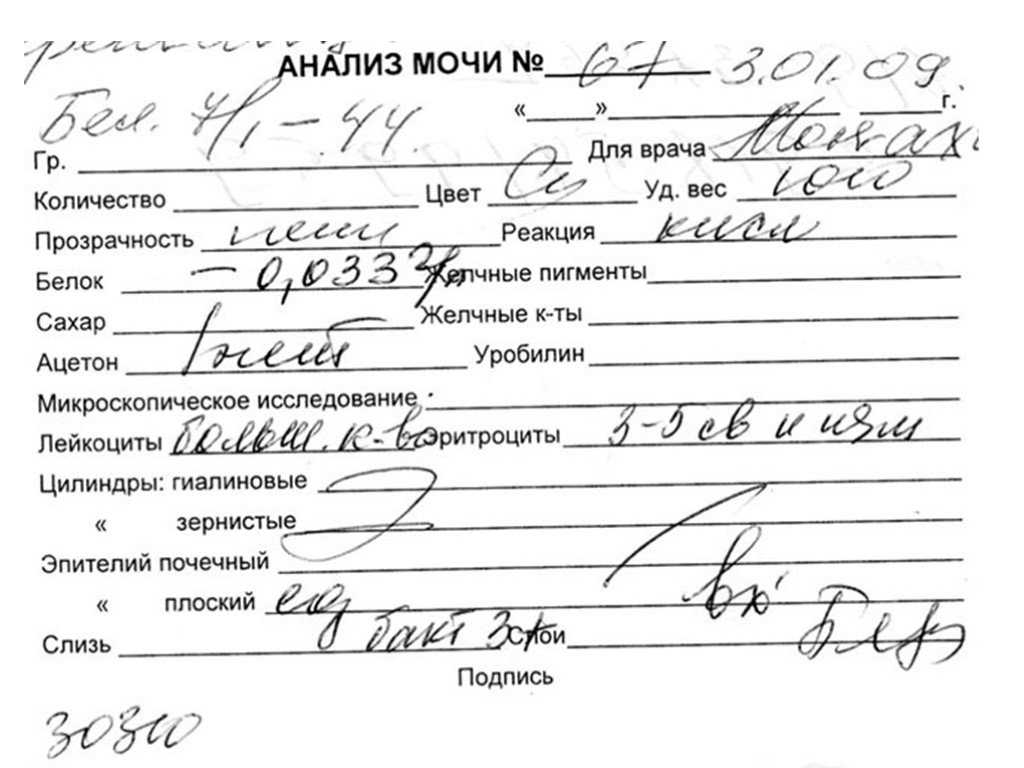 Общий анализ мочи (оам): норма и расшифровка результатов у взрослых в таблице