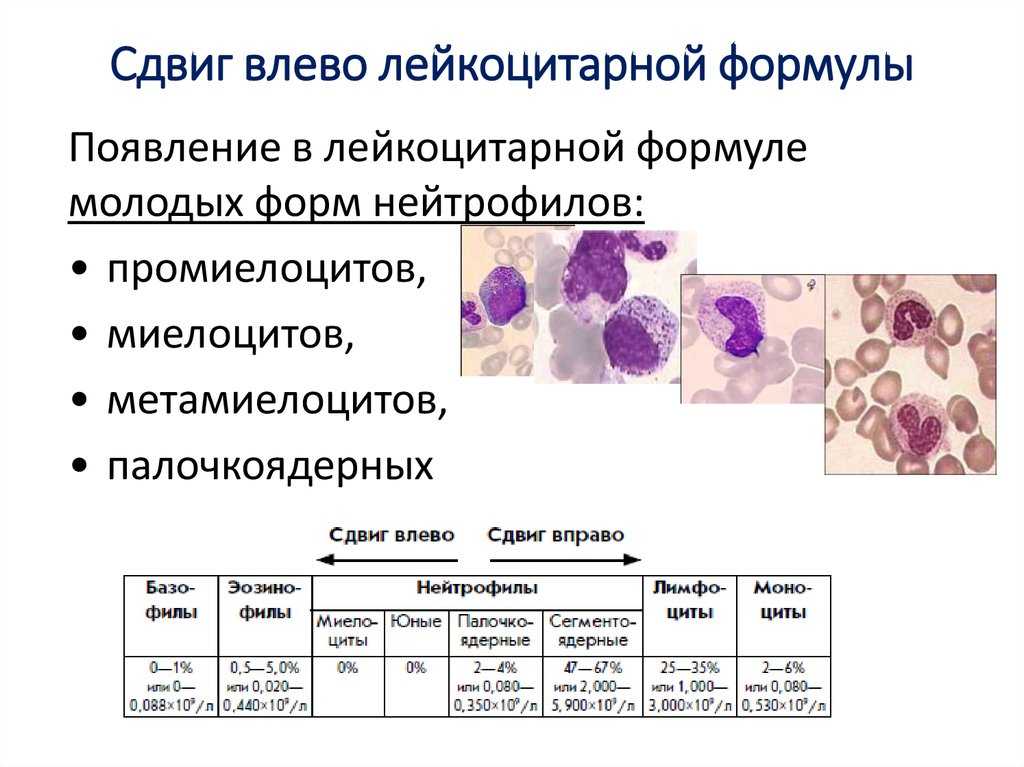 Лейкоцитарная формула крови: расшифровка у детей, норма в таблице результатов анализов