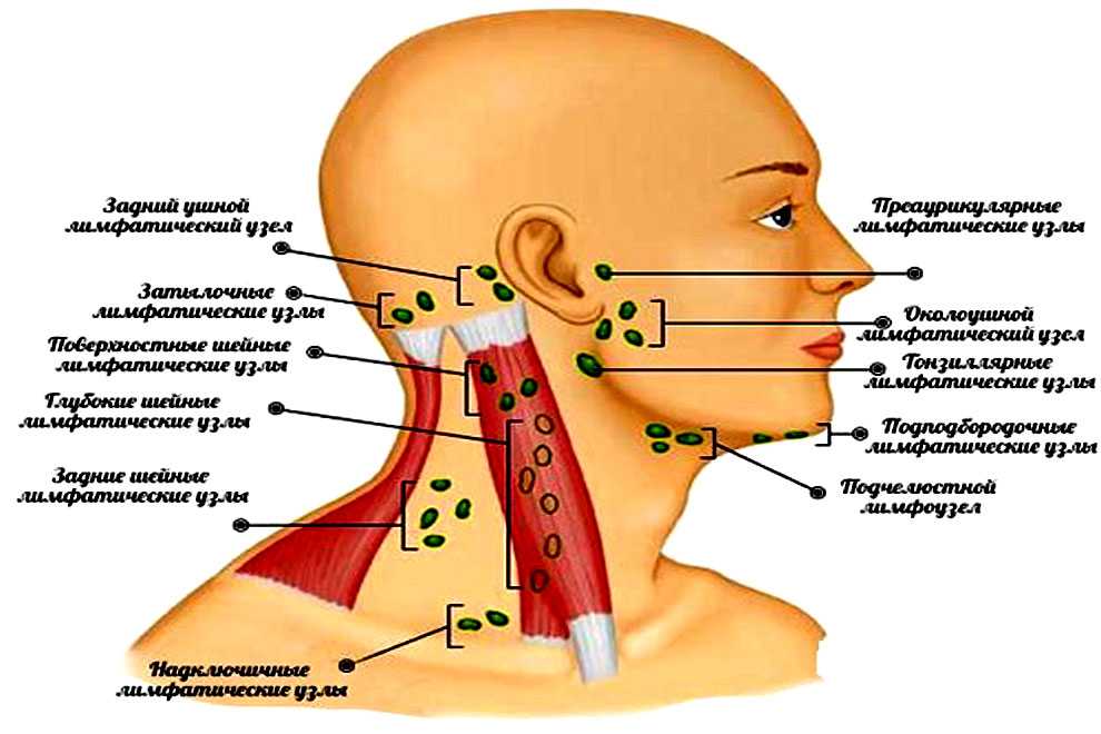 Лимфаденит: что это, симптомы острой и хронической формы, причины, лечение и последствия