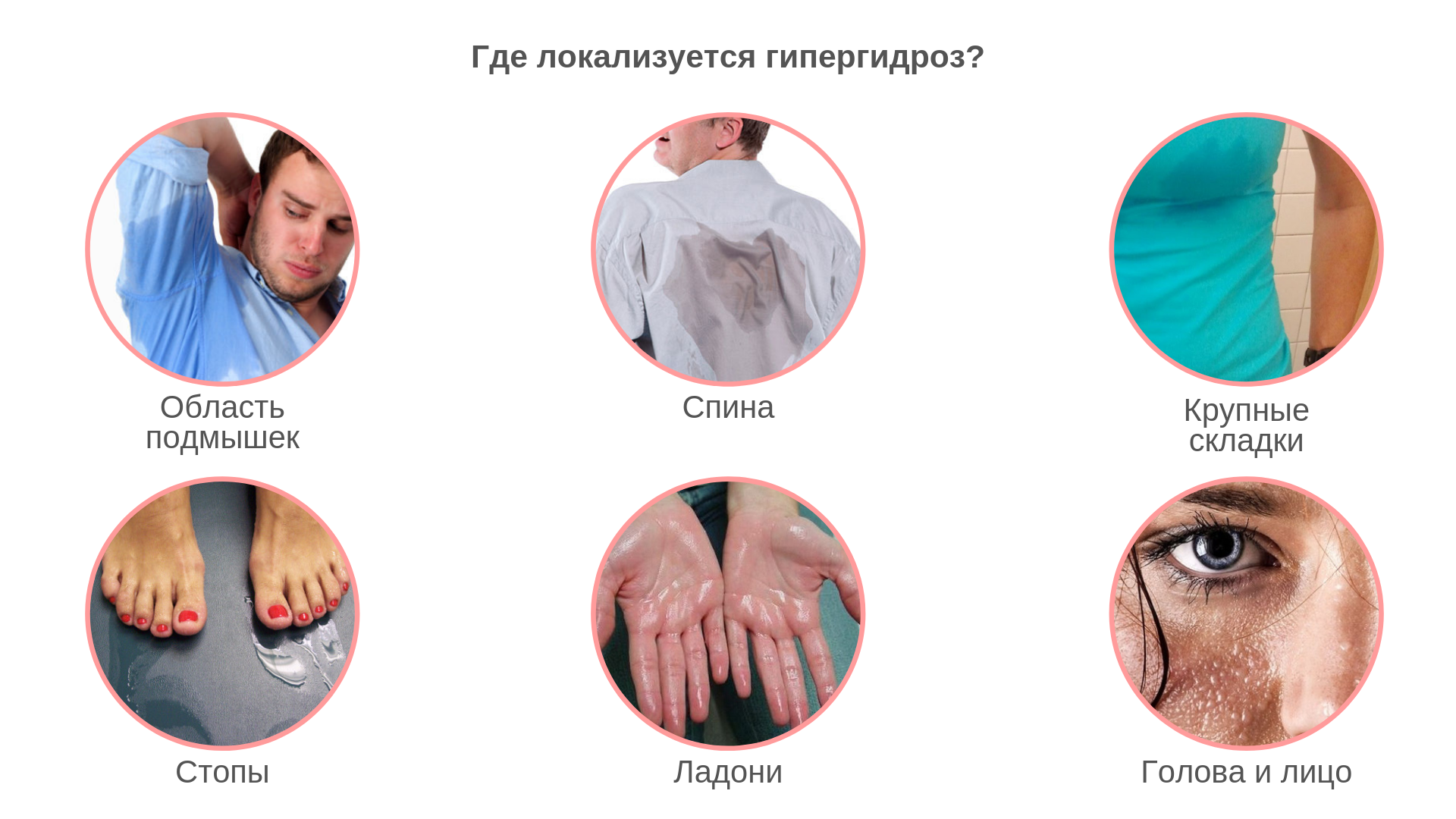 Потеют ноги: неудобная проблема или серьёзная патология