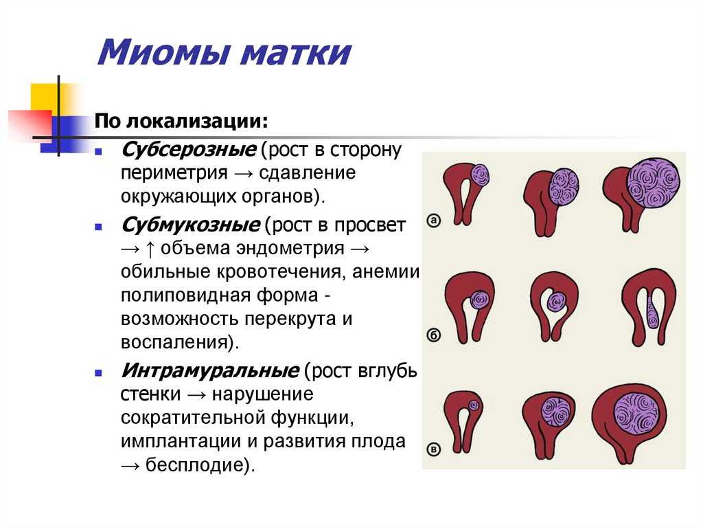 Субинволюция матки: почему не сокращается матка и чем это опасно * клиника диана в санкт-петербурге