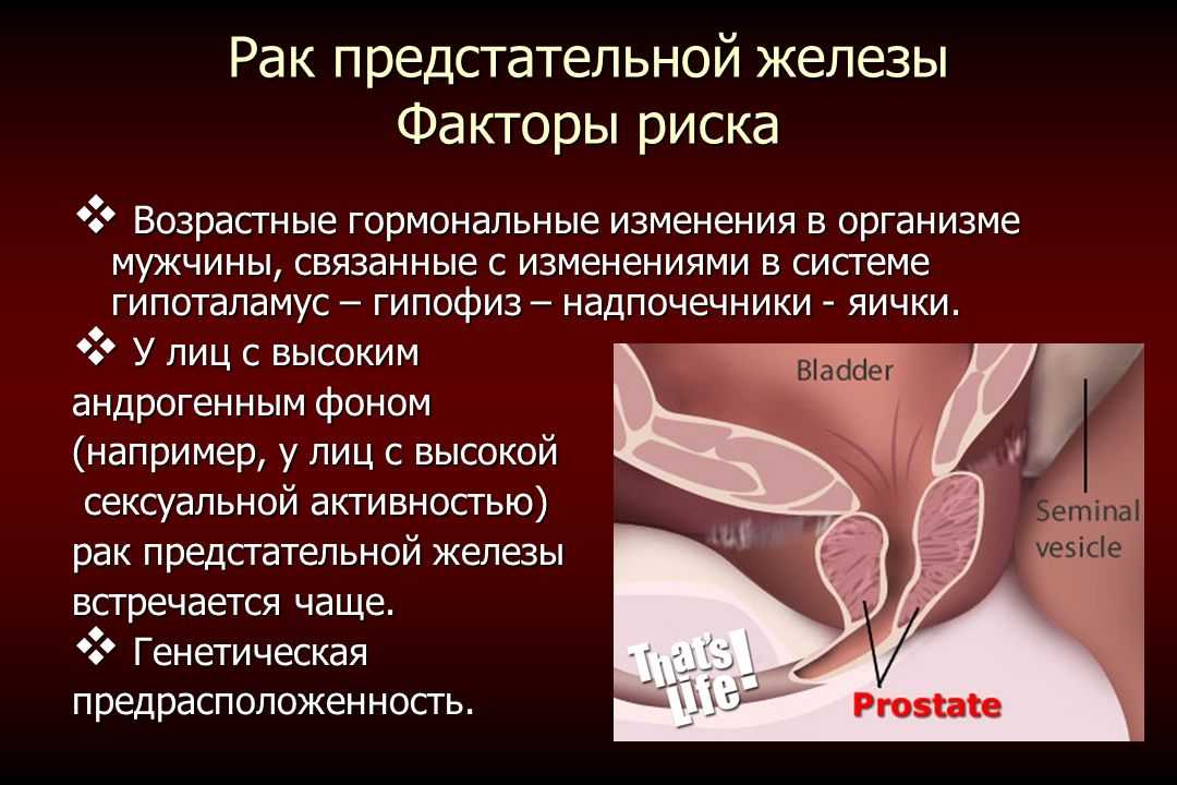 Рак простаты у мужчин: симптомы, прогноз — чингиз а. нугманов