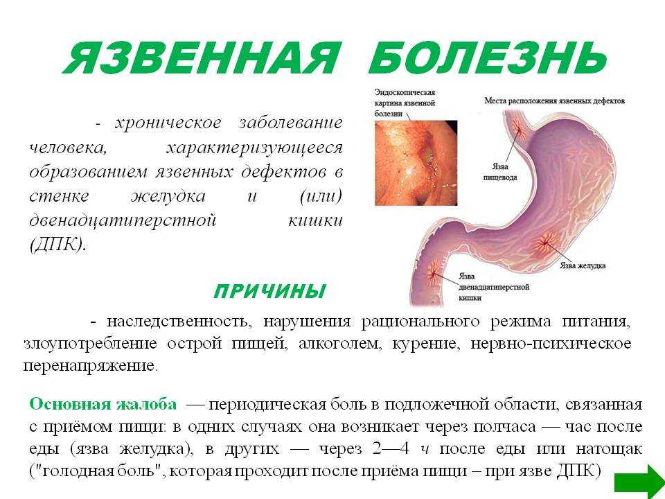 Лечение действия лекарств на желудок. профилактика
