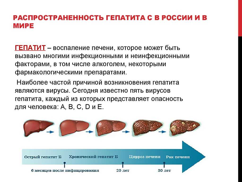Гепатит печени что это. Распространенность гепатита в в России. Распространенность гепатита а. Распространение гепатита а в мире. Распространенность гепатита в в мире.
