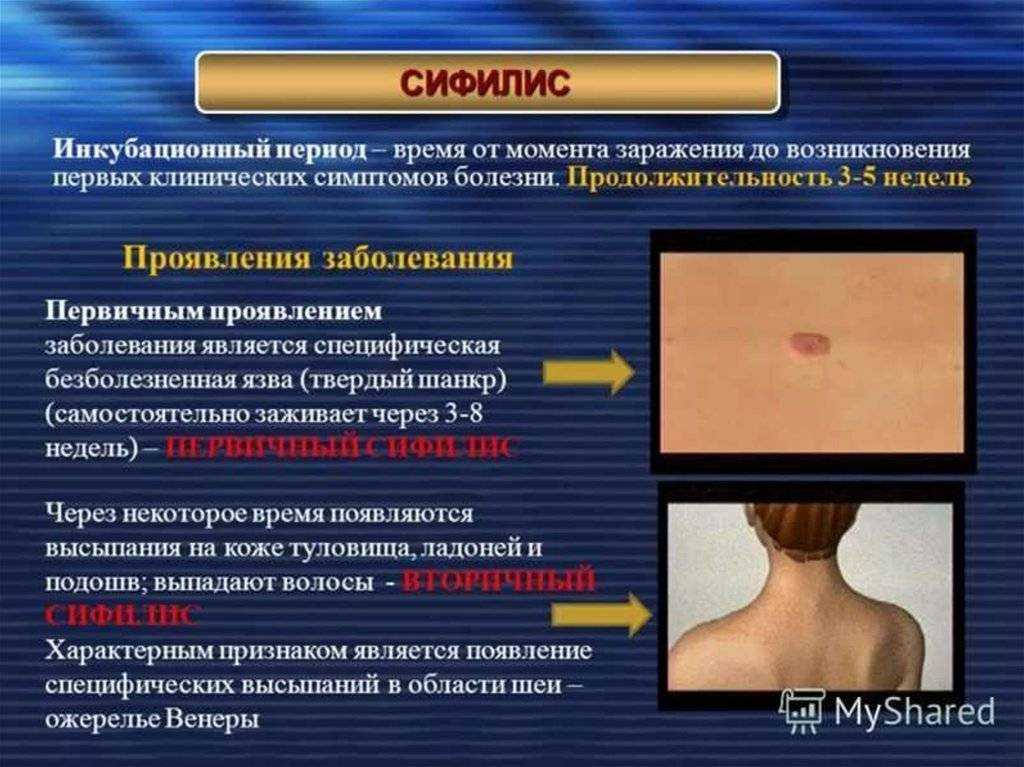 Чем лечить лишай?