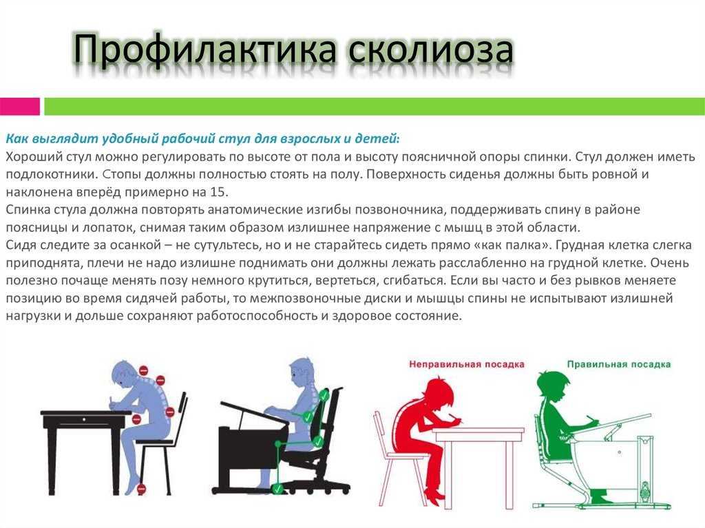 Гимнастика, лфк и комплекс лечебных упражнений при сколиозе