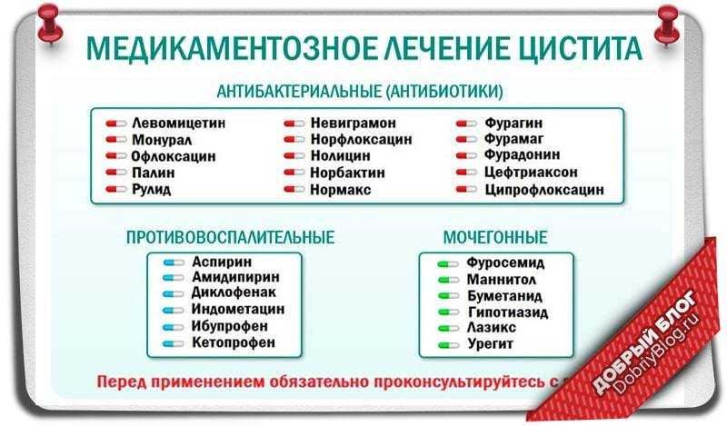 Цистит у женщин: причины, диагностика, симптомы, профилактика и лечение